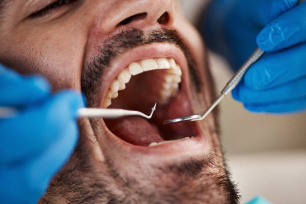 Best Pediatric Emergency Dentist in Potosi, MO